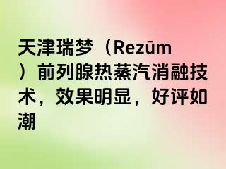 天津瑞梦（Rezūm）前列腺热蒸汽消融技术，效果明显，好评如潮