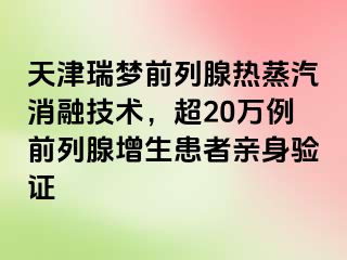 天津瑞梦前列腺热蒸汽消融技术，超20万例前列腺增生患者亲身验证