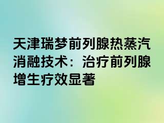 天津瑞梦前列腺热蒸汽消融技术：治疗前列腺增生疗效显著